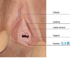 处女膜修复真能“以假乱真”?